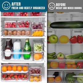 Stelive 10 Pack Fridge Organiser, Stackable Refrigerator Organiser Bins with Lids, BPA-Free, Kitchen Storage Containers, Clear Fridge Storage